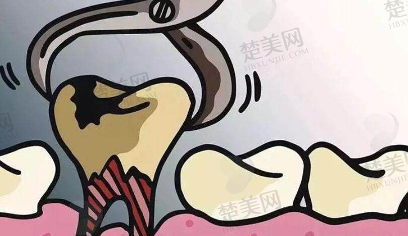 拔牙动漫02..jpg