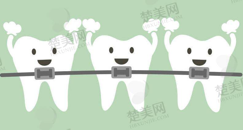 牙齿矫正动漫19.jpg