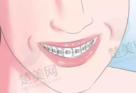 牙齿矫正动漫h5.jpg