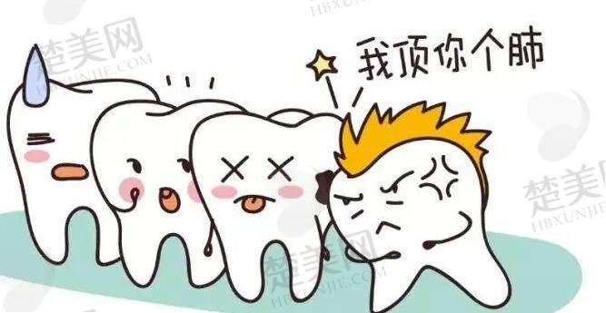 牙齿矫正动漫33.jpg