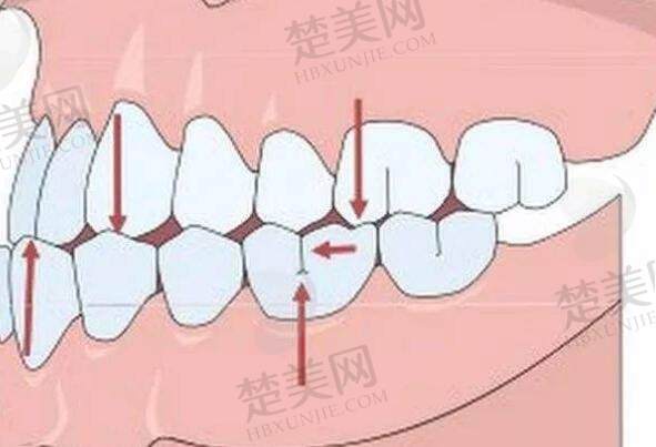 牙齿矫正动漫27.jpg