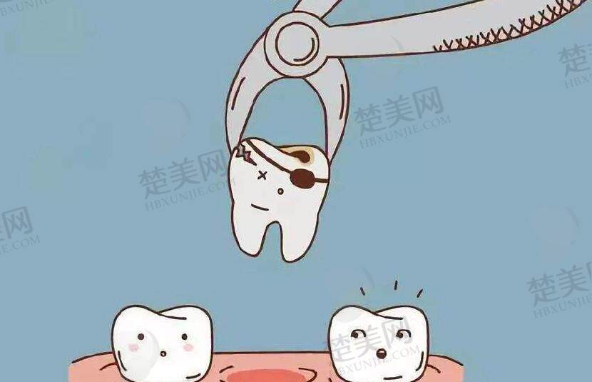 拔牙动漫0.jpg