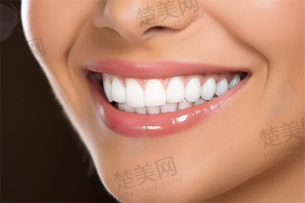 福州维乐口腔(闽侯万家广场店)是私立还是公办?种植牙技术结果如何,值得信赖吗?