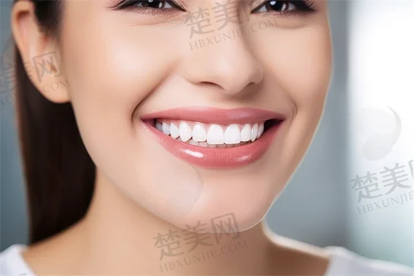 安顺关岭健美口腔诊所牙齿美白体验回顾让你的微笑焕发自信,开启美丽新篇章的旅程