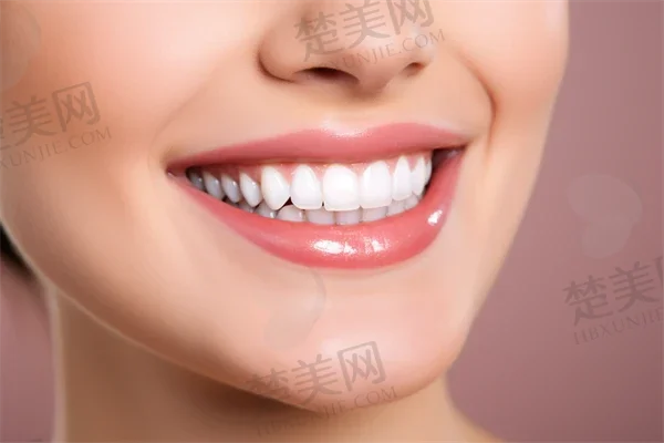 宁波薇琳口腔口碑如何?拨打宁波薇琳口腔咨询电话了解更多信息!