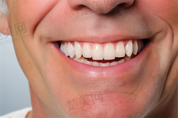 南昌虹桥口腔牙齿矫正技术怎么样?南昌虹桥口腔的口碑评价如何?
