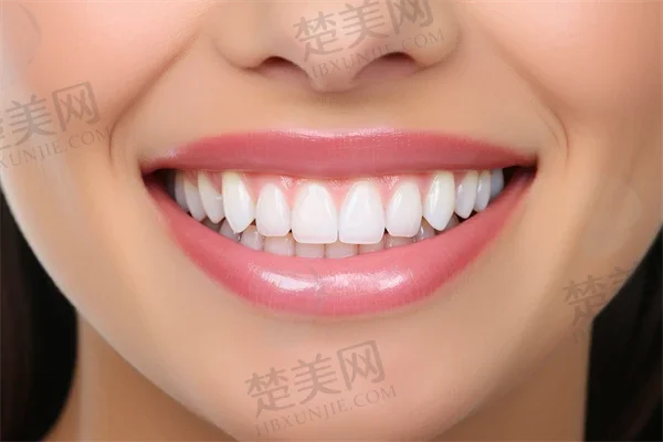 在东莞莞城微笑时代口腔门诊部体验地包天项目的真实感受与收获分享,揭示我的独特经历与成果。