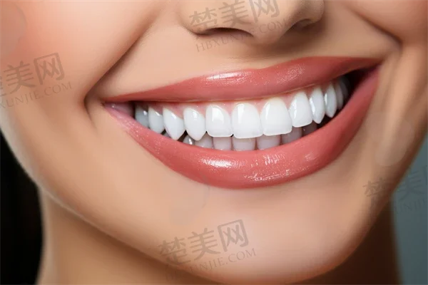 深圳珮斐口腔种植牙技术怎么样?专業团队助力口腔健康,个性化方案让您重拾自信笑容!