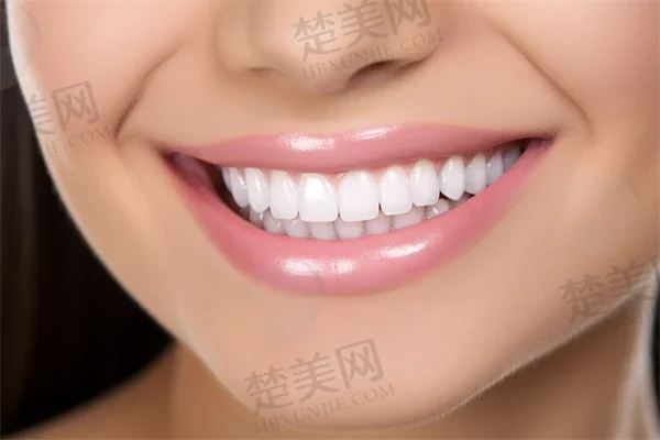 南阳牙齿美白费用是多少?2025年牙齿美白价格表曝光,附带牙贴面价格简析!