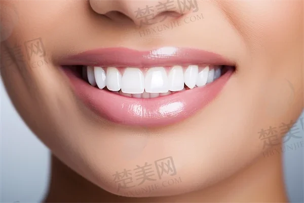 承德瑞邦口腔门诊部价格是否有折扣?医院确实提供了优惠,价格亲民又实惠!