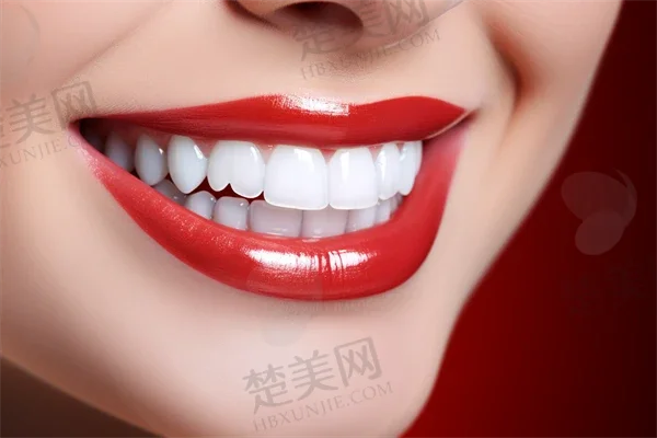 深圳雅品汇口腔诊所设备是否先进?答案是设备相当先进,技术,功能强大。