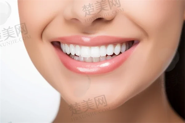 江门齿美口腔是私立还是公办?种植牙技术结果如何?