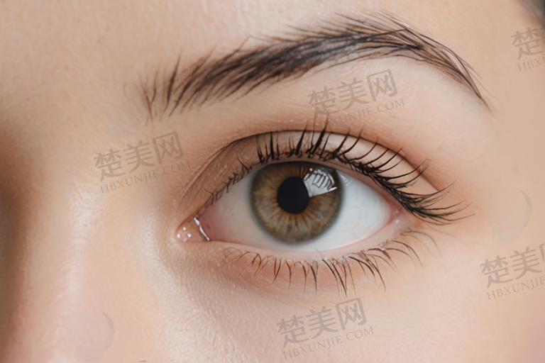 王莺上海和平眼科医院,王莺上海和平眼科医院怎么样?