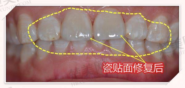 义乌傅氏口腔医院好不好?先进设备、专业医师护航,口腔诊疗体验超棒!