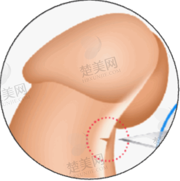 重庆星荣整形外科医院李世荣带来超值福利，假体三件套4.8万起开启你的美丽新生！