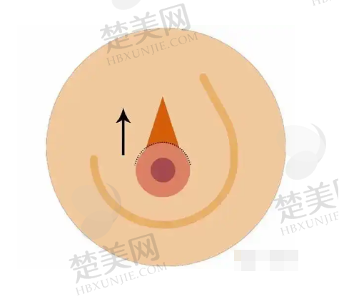 六、贵阳美莱医疗美容医院价格表