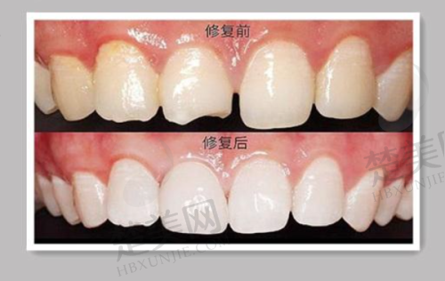 九、嘉兴曙光口腔医院真实的患者评价