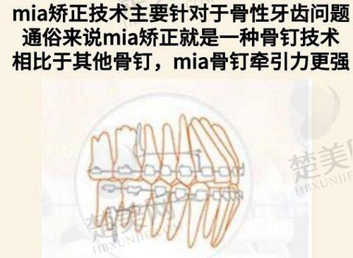 二、厦门魅湃整形外科门诊部怎么样?
