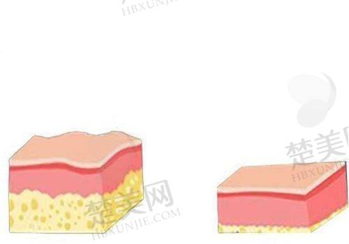 六、柳州新生天美医疗美容门诊部(植发科)价格表