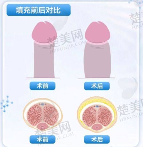 雷子凌