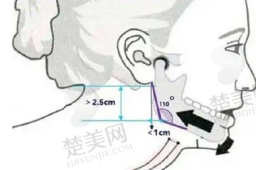 四、魔法超拉皮靠谱吗？综合判断