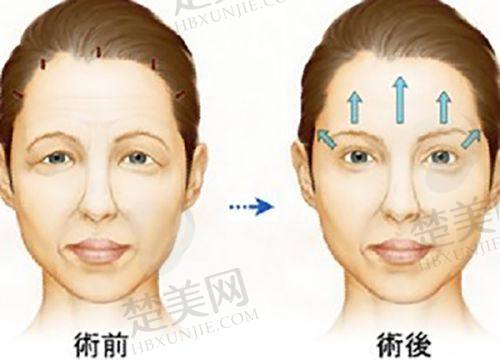 3. 改善层次受限