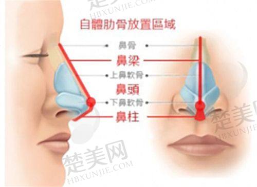 九、柳州新生天美医疗美容门诊部(植发科)真实的患者评价