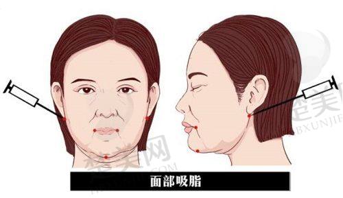 三、如何选择适合自己的整形医院