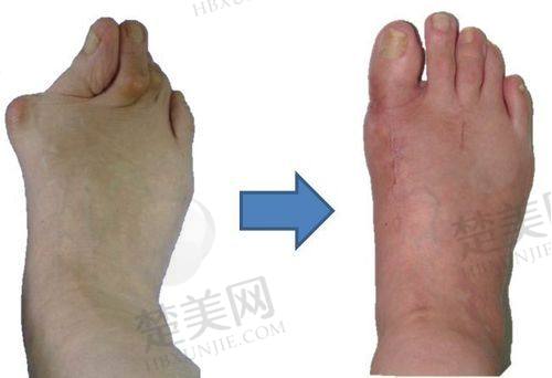 七、梁军 医生真实的患者评价