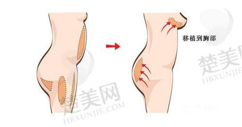 七、成都高新米兰柏羽医学美容医院地址及交通