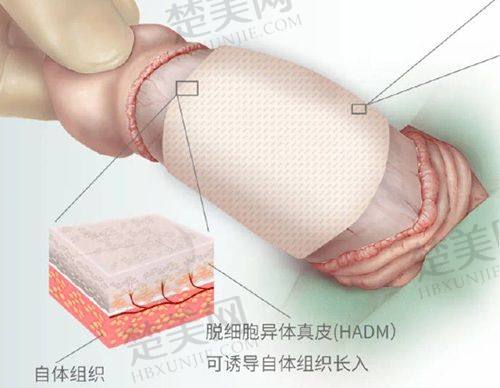 四、成都高新米兰柏羽医学美容医院特色项目
