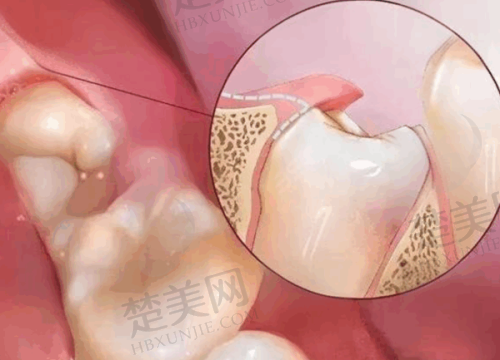 九、兰州皓亚口腔诊所真实的患者评价
