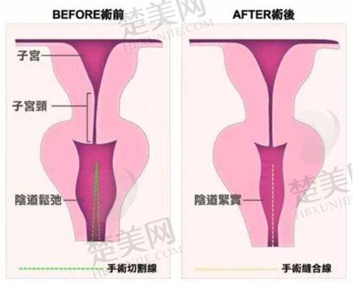 九、宝鸡韩美医疗美容门诊部真实的患者评价