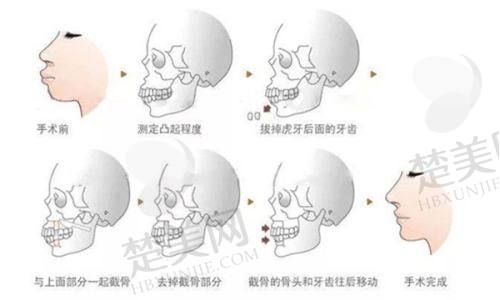 四、山东滨州方超医学美容——专注整形的可靠之选