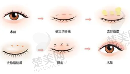 2025保定整形医院排名前十揭晓，悦美、蓝山等口碑佳医院助你寻理想变美地