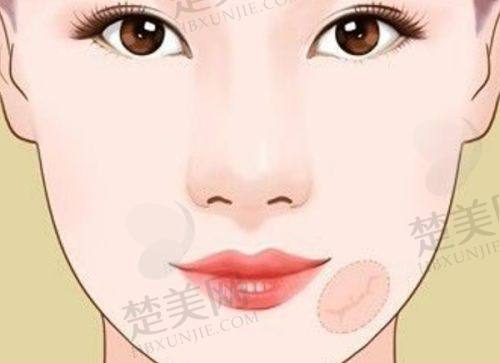 二、山东滨州曦朵医疗美容——综合整形打造全方面美丽
