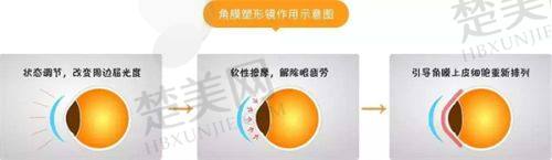 三、昆明眼科医院诊疗项目有哪些？