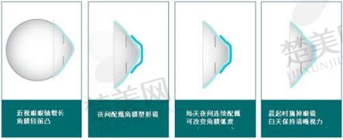 二、昆明眼科医院怎么样？