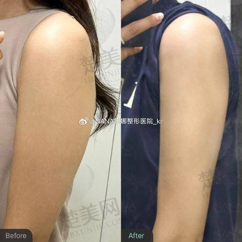 眼部相关项目