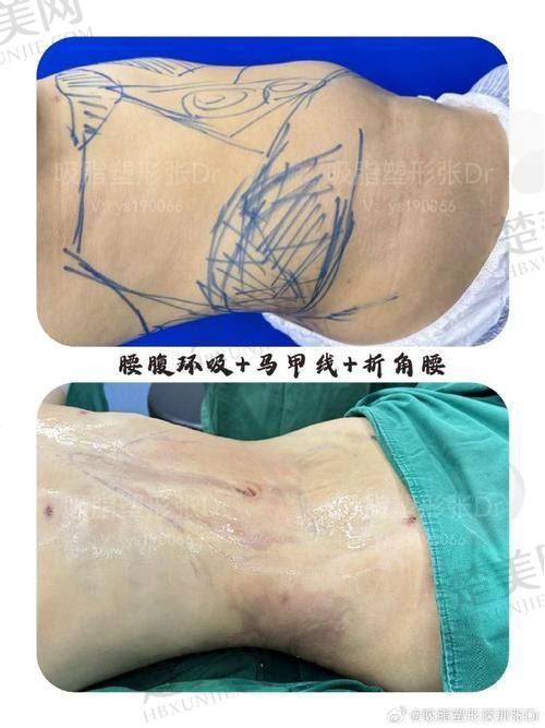 四、杭州彭涛医生的预约方式