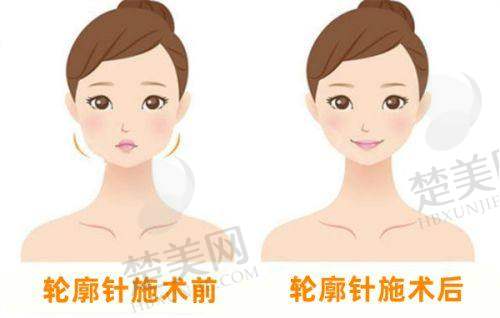 三、西宁时光整形美容医院诊疗项目有哪些？