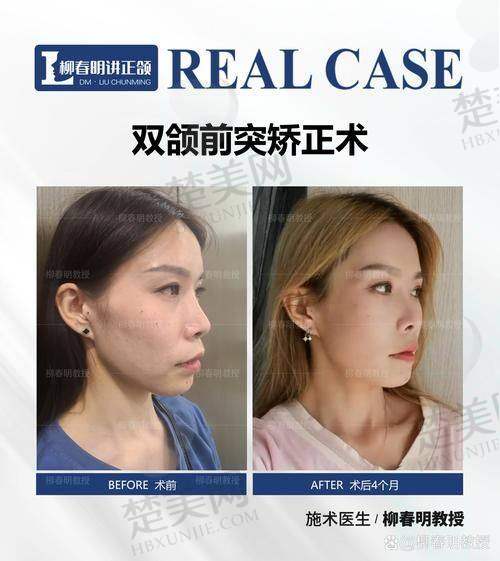 一、李继华医生简介