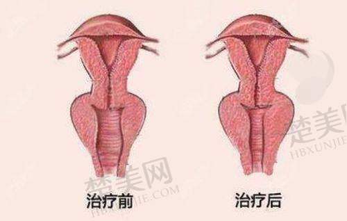 五、西宁时光整形医院是正规医院吗——服务优势特别贴心