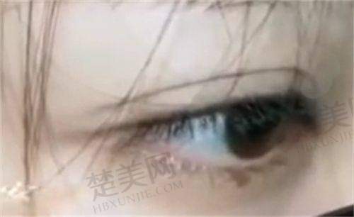 成都星范医疗美容整形门诊隆鼻价格参考