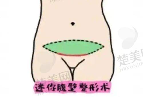 二、乌鲁木齐整形医院怎么样？