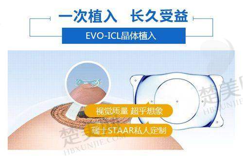 四、北京茗视光眼科医院特色项目