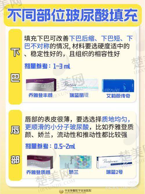 其他项目与优势