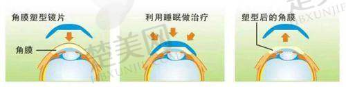 一、北京茗视光眼科医院正规吗？