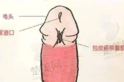 四、西 京医院微整形骨干医生垫下巴科普