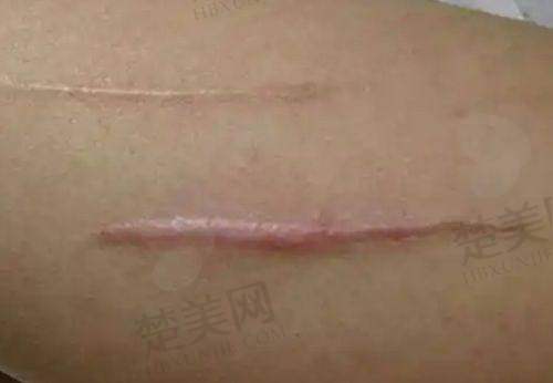 九、厦门菲思美科整形外科门诊部真实的患者评价
